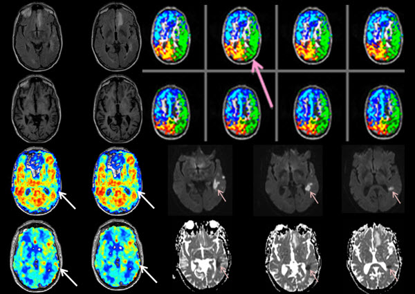 Correlating Hemodynamic Magnetic Resonance Imaging with high-field ...