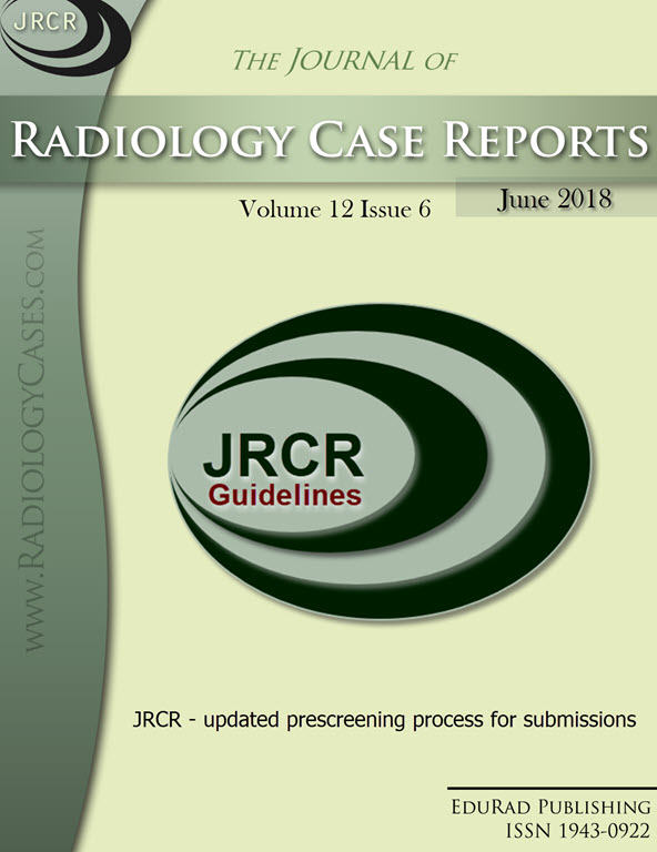 Archives Free Journal Access Radiology Journal
