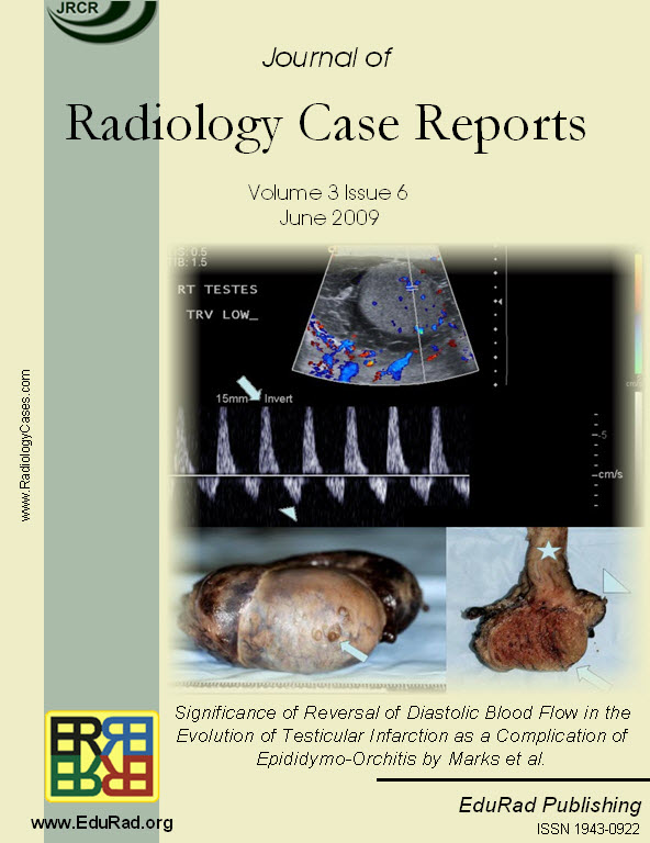 Cover page of the June 2009 issue. Significance of Reversal of Diastolic Blood Flow in the Evolution of Testicular Infarction as a Complication of Epididymo-Orchitis by Marks et al