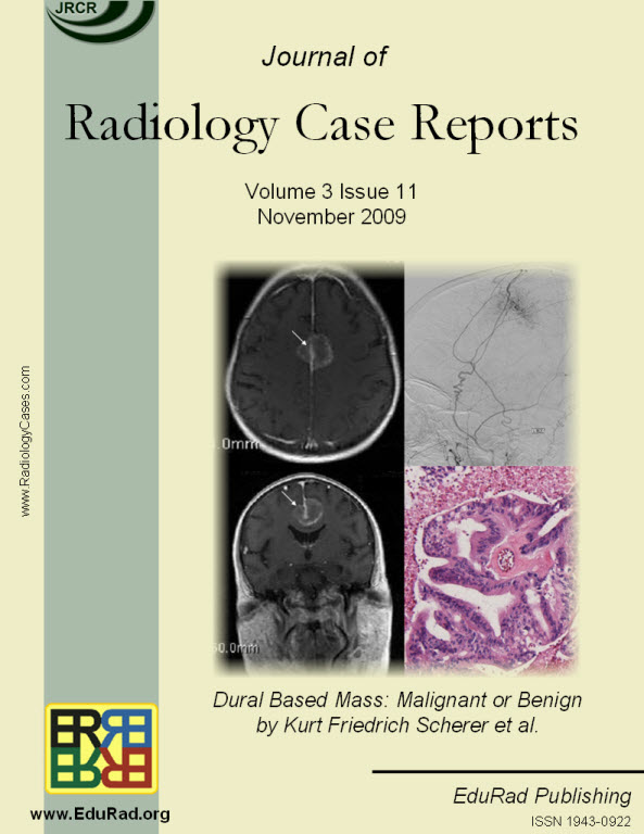 Archives Free Journal Access Radiology Journal