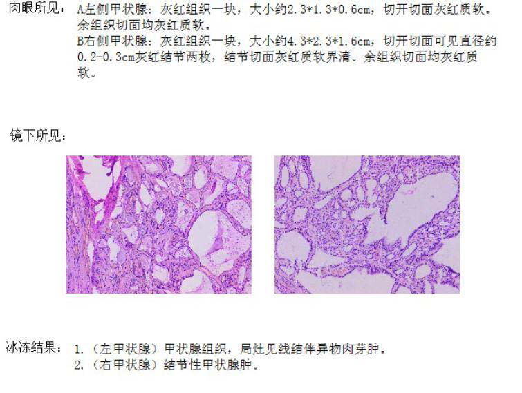 (a) Postoperative pathology;